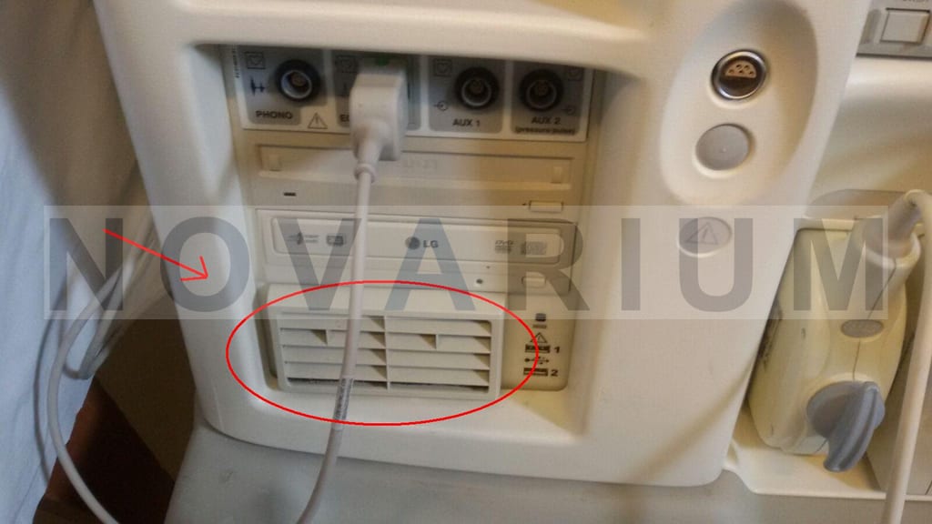 GE Bep Filter Vivid 7.JPG
