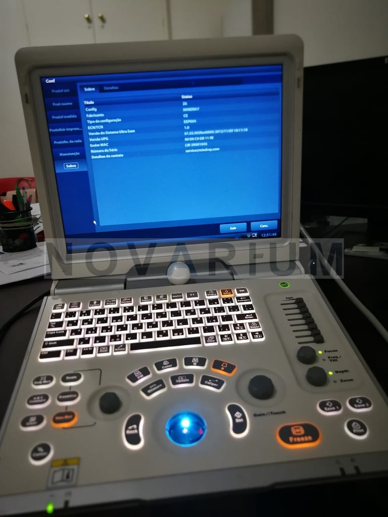 Mindray 801-1150-00015-00 - Trackball.jpg