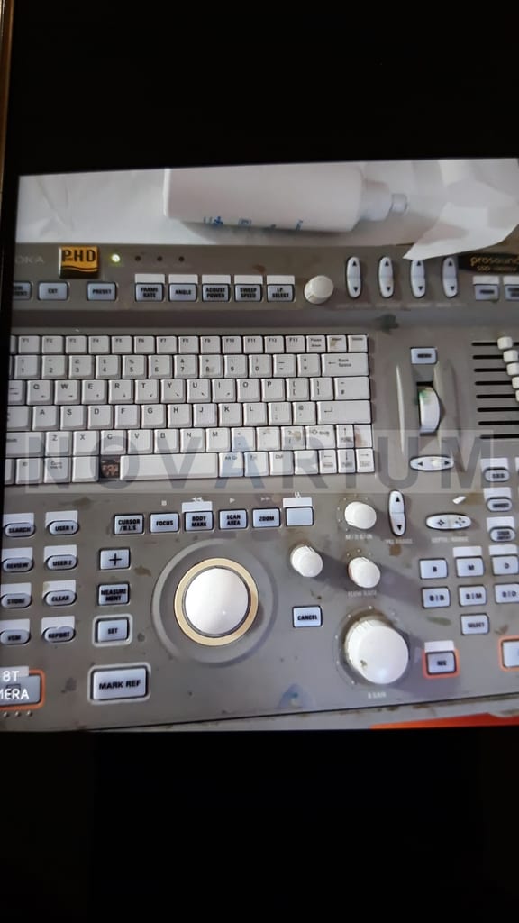 Aloka L-Key-75 - User Interface.jpeg