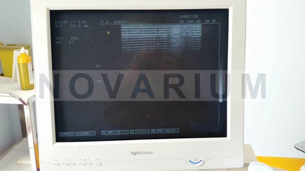 Esaote 9102854030 Monitor 17(1).jpg