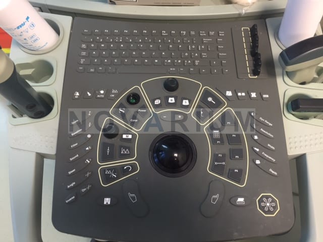Ultraview 800 User Interface (1).JPG