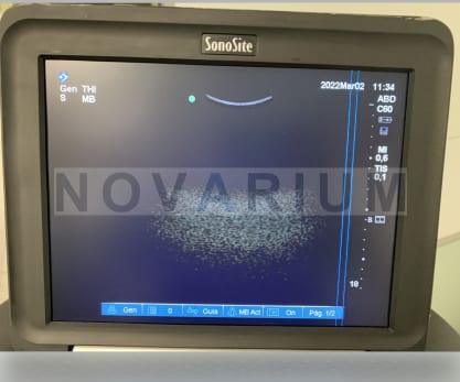 Sonosite p15000 - LCD Screen.png