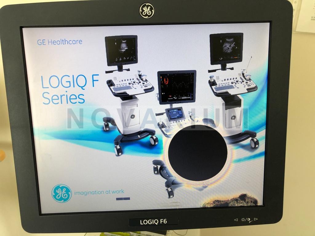 GE V8117C80-10 - 17- LCD Display 5442188-3.jpg