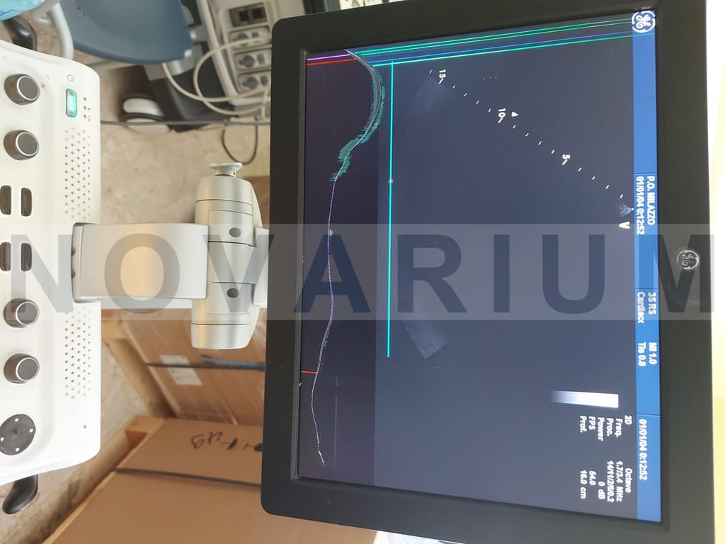 GE S2418525 - 15- LCD Monitor 2-D190-1001.jpg