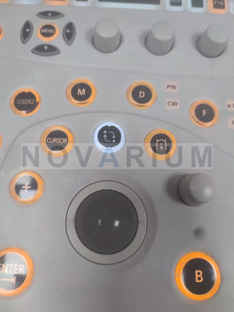 Aloka - Trackball (2).jpg