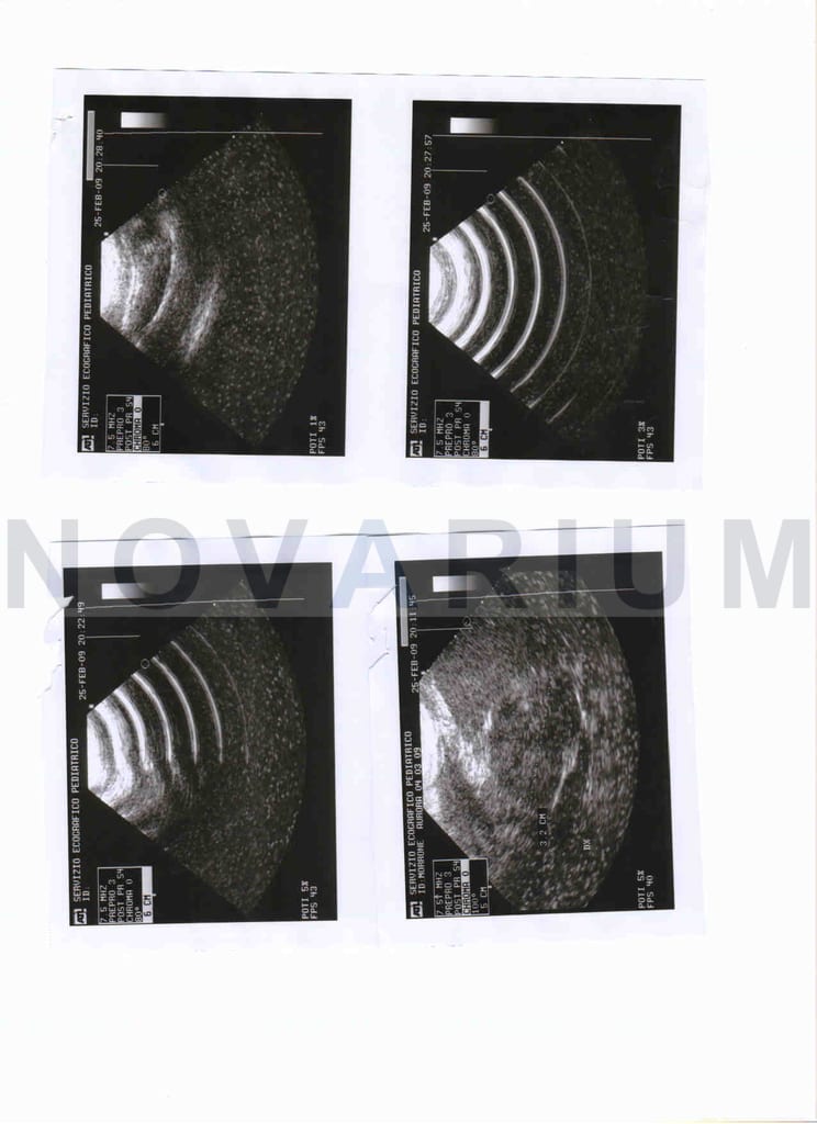 ATL 7.5-13 mm AA sn AL0656.jpg
