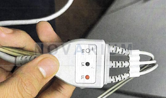 Siemens 11147098 - Cable, CPM, ECG Patient Harness, (3).png